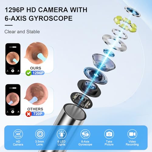 High-Definition Ear Wax Removal, Wireless Ear Cleaner, Safe and Gentle Ear Wax Removal Kit, Rechargeable Ear Cleaner with Camera and Light, Ear Cleaning Kit for Android and iOS (Black)