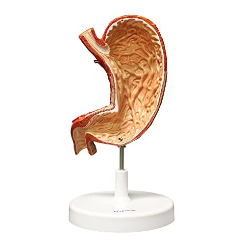 Image of B10440 Stomach Model, 1.5X Life Size, 2-Parts