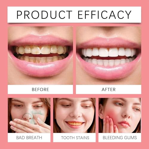 Sp8 Toothpaste,SP-8 Ultra Whitening Toothpaste,SP8 Probiotic Tooth Paste with a Toothbrush,for Bright Smiles,Deep Cleaning/Fresh Breath/Oral Care(100g) - Image 8