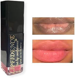 Lip Lightening for Dark Lips Lip Brightener for Smokers Dark Lip Treatment Lightening Cream for Pink Lips Lip Lightener for Smoker Lips Lip Lightening balm for Men and Women 10ml