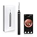 Price comparison product image WiFi Ear Otoscope Camera, TIMESISO Ear Inspection Endoscope 1080P FHD Lens Ear Cleaner with 6 LED Lights, 6-Axis Gyroscope Earwax Removal Tool for iPhone and Android, Tablet and Mac