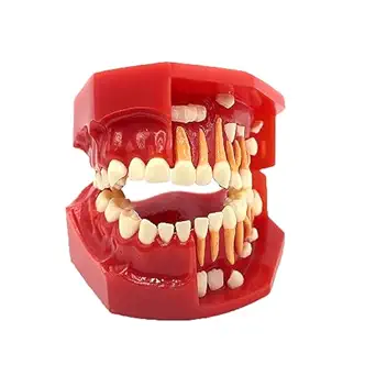RUCYAI Dental Pediatrics Teeth Model Children Primary Permanent Alternate 3-12 Years Old (3-6 Years Old)