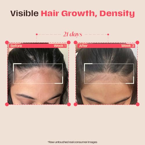 Image of Days Ahead Leave-in Hair Growth Ampoule Serum (Roll on) | 16% Growth Actives | PDRN, Redensyl, Anagain | Hair Growth Serum | Promotes Growth, Increases Density | Non-Greasy | For Women & Men | 25 ml