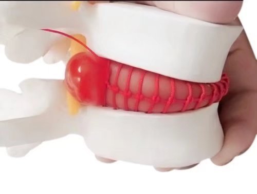 BoNew Lendenwirbel-Modell 1:1,5 – 4. & 5. Wirbel Mit Bandscheiben, Rückenmark & Nerven, Flexibel, Für Orthopädie & Unterricht