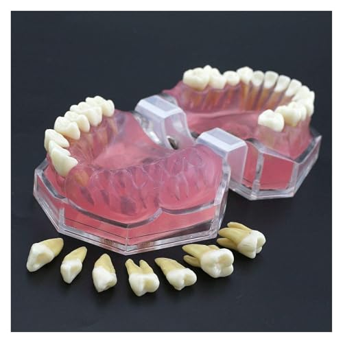 Modelo dental con encías de gel y 28 dientes extraíbles 5