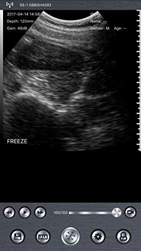 Portable Wireless Wifi Scanner Linear Array Probe 7.5Mhz 80Elements 16Channel Connect To Pc Tablet Smartphone. Ios And Android Compatible For Farm Animals Cattle Horse Camel Equine Goat Cow And Sheep #TOP6