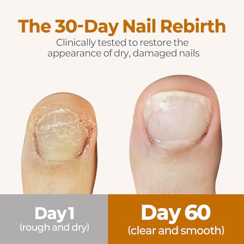 TuneTune Cuticle Oil 8ml | Fermented Korean Nail Oil for Nails & Cuticles | Moisturizing Nail Care Oil for Dry Cuticles | Lightweight Oil for Healthy-Looking Nails | Easy Dropper Application — view 2