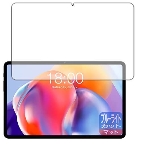 PDA�H�[ Teclast T40S�Ή� �u���[���C�g�J�b�g[���˒ጸ] �ی� �t�B���� ���{��