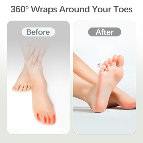 Image of 50 Pcs Silicone Anti-Friction Toe Protector, Breathable Toe Sleeves, Soft Clear Gel Toe Protectors for Men and Women, Little Toe Covers for Corns, Blisters, Calluses, Pain Relief