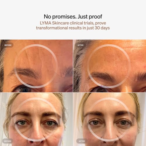 Skincare Serum and Cream, Starter Kit - Image 7