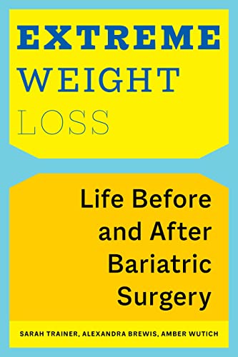 Extreme Weight Loss: Life Before and After Bariatric Surgery (English Edition)