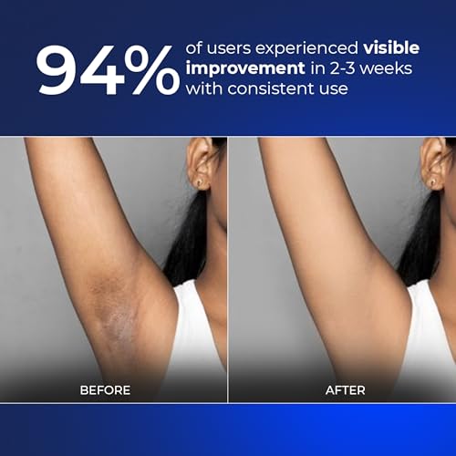 Image of Aqueria 5.5% AHA BHA French Underarm Brightening Roll On | 48H Odour Control | Flora Fragrance with 2% Niacinamide | Multi Actives, Glycolic Acid, Lactic Acid | Prevents Odor, Kills Bacteria | Exfoliates, Reduces Pigmentation & Discoloration for Even-Toned Underarms | Brightens Skin & Exfoliates Underarm | Alcohol & Aluminium Free | Deodorant for Men & Women | 50ml