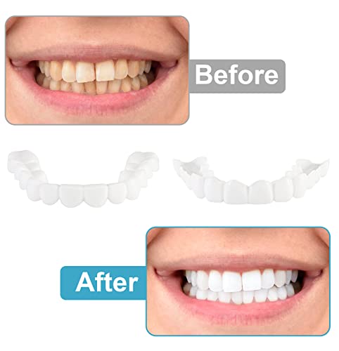 Fake Teeth, 2 Pcs Veneers Teeth For Women And Men, Dental Veneers For Temporary Tooth Repair Upper And Lower Jaw, Protect Your Teeth And Regain Confident Smile, Bright White-Lq3 #TOP5