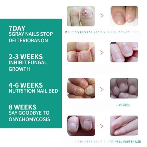 Image of 35ml Natural Nail Surface Repair for Pitted, Cracked, and Brittle Nails | Oil Blend to Heal Damaged Nails Beds, Stimulate Growth, and Enhance Strength