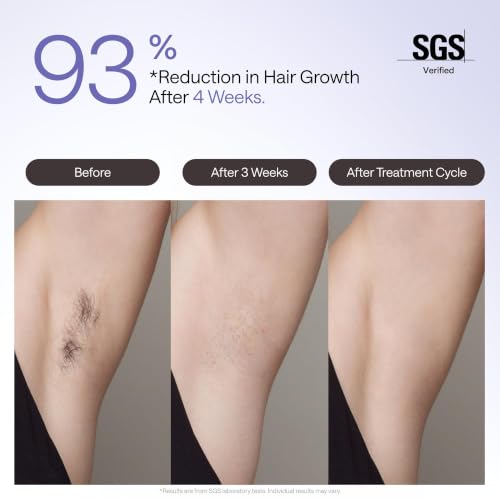 Image of Ulike Air 4 IPL Hair Removal Device with Bikini Razor, Ice-Cooling Permanent Hair Reduction for Women and Men, USHR Mode, Nearly Painless At-Home Hair Removal in 10 Minutes