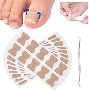 Ingrown Toenail Correction Sticker, 9pcs Ingrown Toenail Correction Stickers Ingrown Toenail Patch Planing Tool Ingrown Toenail Corrector Strips Nail Treatment Foot Care Tape for Home Salon