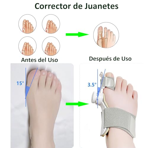Reviews y listado de Corrector juanetes del mes. 15 Imagen adicional