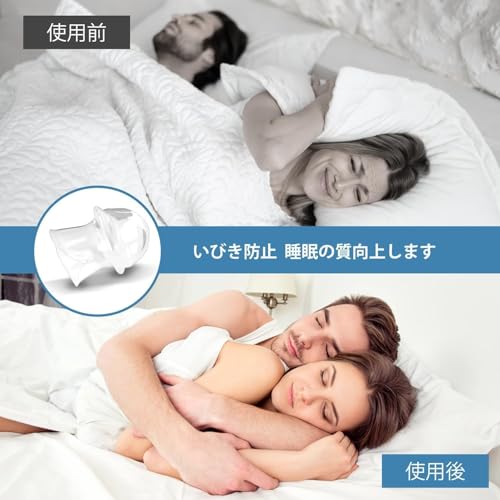 Nobetta いびき防止 舌用マウスピース