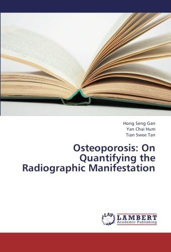 Osteoporosis: On Quantifying the Radiographic Manifestation