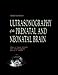 Ultrasonography of the Prenatal &  Neonatal Brain
