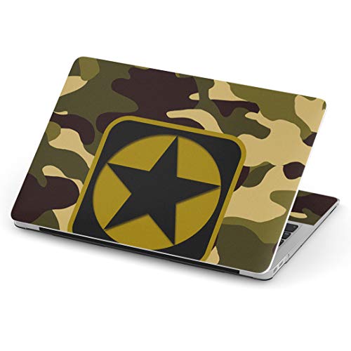 igsticker MacBook Air 13inch 2018 2019 2020 f / A1932 pXLV[ }bNubN GA Mac 13" C` Retina pV[ tB XebJ[ ANZT[ ی (2010N 
