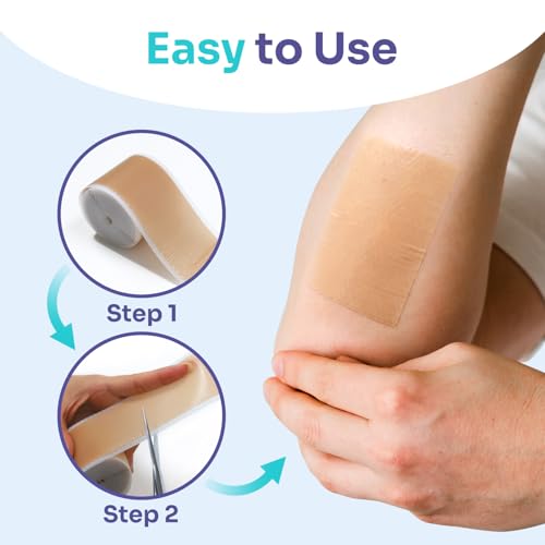 Conkote Silicone Scar Tapes (1.6”x120\" Roll-3M), Scar Reducing Treatments, Keloid Bump Removal for C-Section, Cosmetic Surgical Scars, Stretch Marks, Burn, Acne and Tummy Tuck