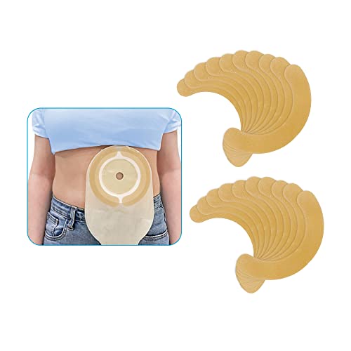 Ostomy Barrier Strips Colostomy Supplies Elastic Barrier Strips For Ostomy Bag Adapt Skin Barrier Extenders No Sting Ostomy Paste Tape Ileostomy Supplies Latex-Free Medical Grade Adhesive (Pack Of 20) #TOP15