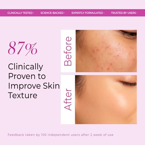 Image of VINR 7% Glycolic Acid Toner For Glowing Skin with 2% Niacinamide & 0.5% Hylauronic Acid |Dull & Uneven Texture, Pores & Blackheads | Hydrating Daily Face Toner for Women & Men | All Skin Types - 500ml(Pack of 5)