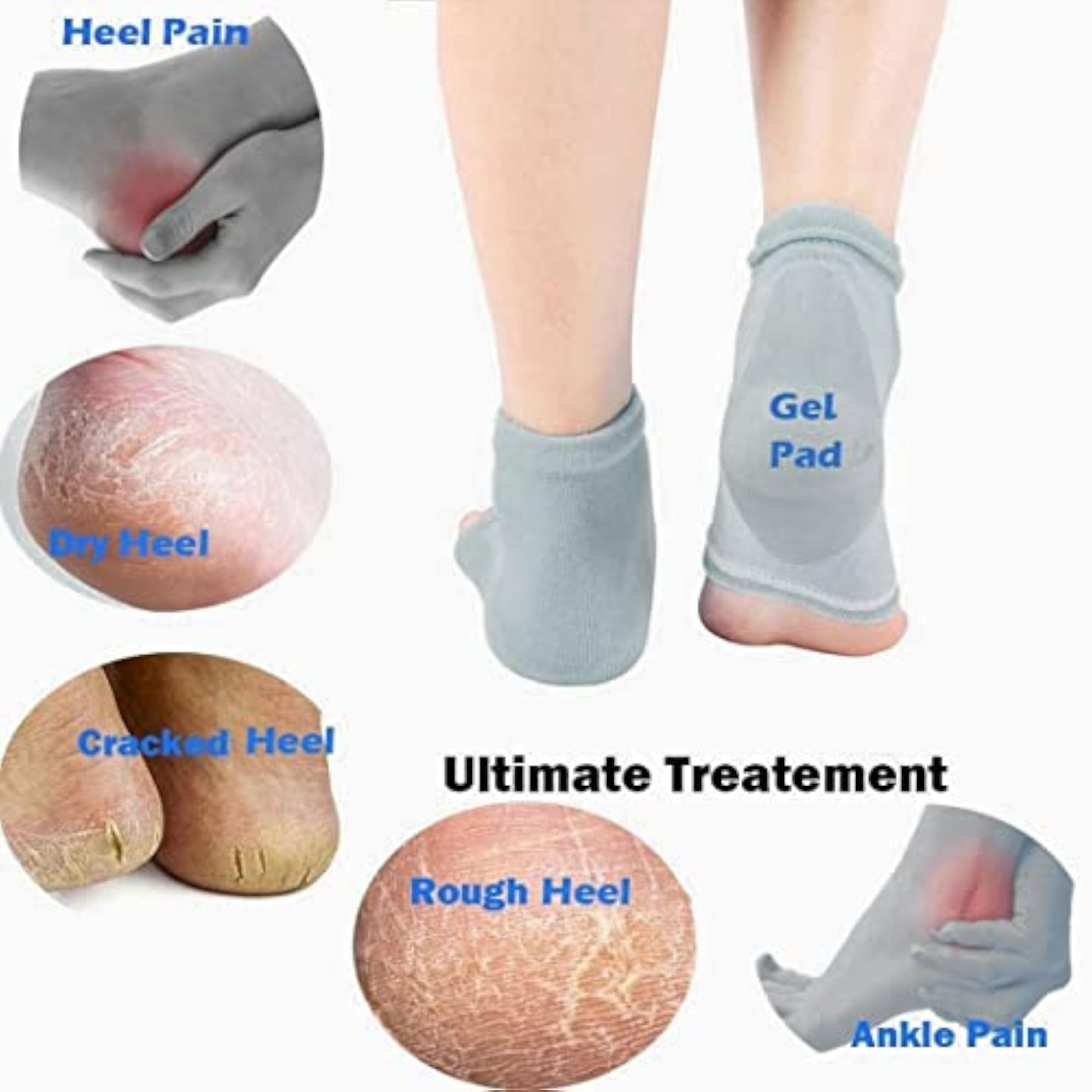 Cotton Moisturising Gel Heel Socks for Cracked Feet, Open Toe