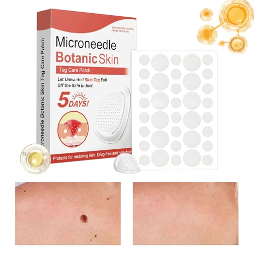 Cerotti Rimozione nei per Viso | Adesivi Elimina Macchie | Cerotti Invisibili per Brufoli e Imperfezioni per Cura della Pelle | Trattamento Notte per Corpo Viso e Piedi