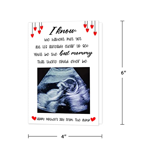 Flyab Happy First Mothers Day Card For Mom First Time Mother's Day Card From The Bump With Photo Insert First Mothers Day Card With Envelope Pregnancy Gift For New Mom Mother To Be Expecting Mom #TOP6
