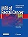 MRI of Rectal Cancer: Clinical Atlas