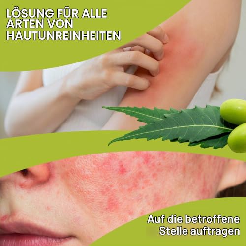 Organisches Neemöl - 100% Rein und Natürlich für Gartenarbeit, Tierpflege und Haut - Insektenschutzmittel, Aknebehandlung und Mehr - Kaltgepresst - 100 ml