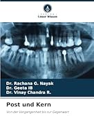 Post und Kern: Von der Vergangenheit bis zur Gegenwart (German Edition) 6208714362 Book Cover