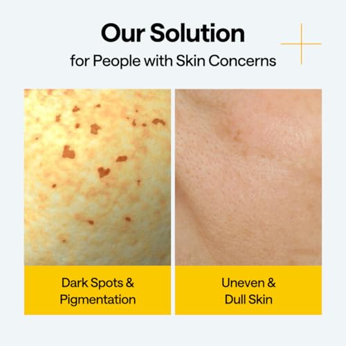 Image of MEDIHEAL Wrapping Serum Mask [Vitamin C] - Contains 98% Pure Vitamin C & Niacinamide for Glow Boosting - Helps Improve Radiance for Dull Skin & Evens Out Skin Tone - Provides Healthy Glow (10 Sheets)