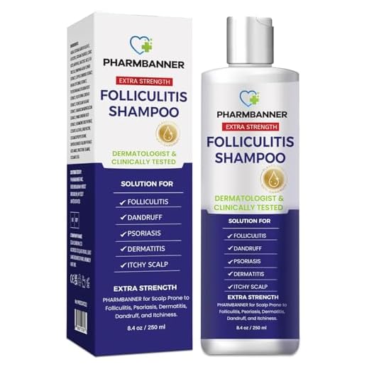 Folliculitis Shampoo, Seborrheic Dermatitis Shampoo, Anti Dandruff Shampoo, Antifungal Shampoo, Folliculitis Treatment, Dandruff Treatment, Scalp Psoriasis Treatment, Relieve From Itchy & Dry Scalp