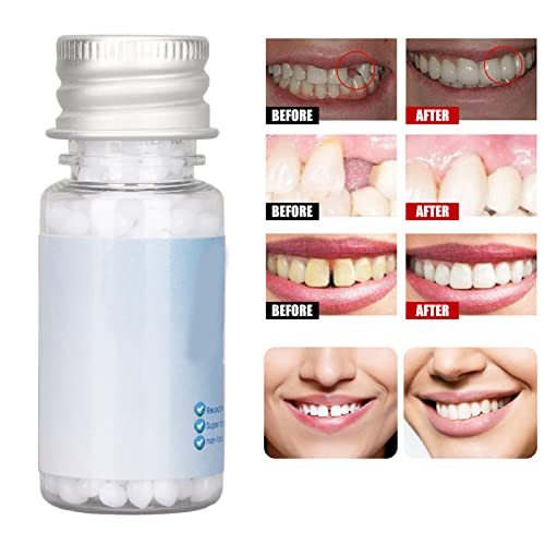 Grânulos de reparo de dente, kit de cuidados de fixação de preenchimento dentário temporário para de