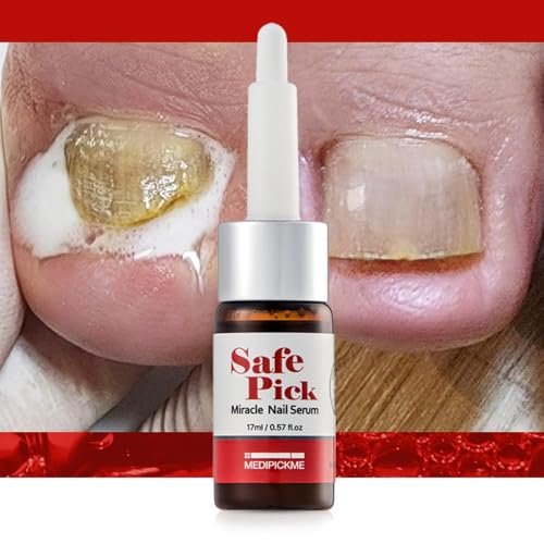 Safepick Intensive Nail Strengthener Serum for Weak, Thin & Damaged Fingernails - Keratin & Biotin Formula for Restoration & Growth Support - Quick-Drying - Image 5