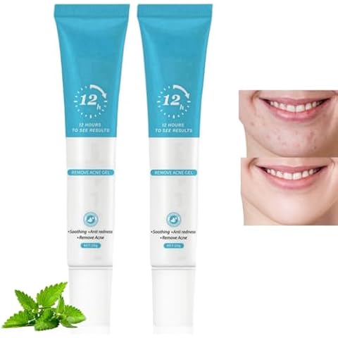 ChengJin Acne Treatment Gel for Dark Spots Cover