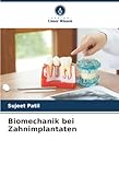 Biomechanik bei Zahnimplantaten: DE