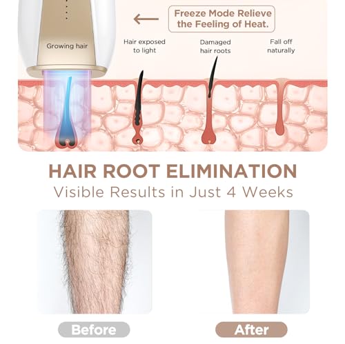 Laser-Hair-Removal-for-Men-and-Women-PLAVOGUE-Hair-Removal-Safe-at-Home-for-Long-Lasting-Body-and-Hair-Removal-for-UnderarmBikini-and-LegWhite