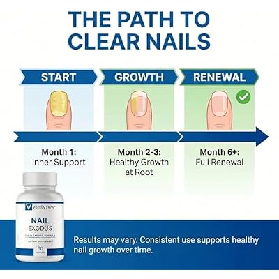 Nail Exodus - Vitality Healthy Nails - Premium Formula for Healthier Feet - 60 Capsules