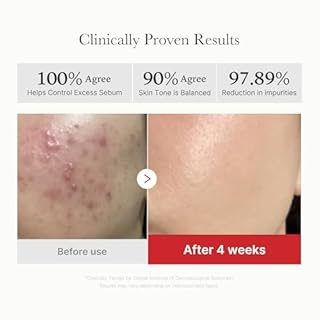 medicube Toner Pads Red Succinic Acid Panthenol Facial Peeling Pad | Exfoliating Toner Pad for Breakout-Prone Skin | Niacinamide, AHA, BHA, and Soothing Panthenol - Non-Comedogenic, 70 Pads (1 Pack)