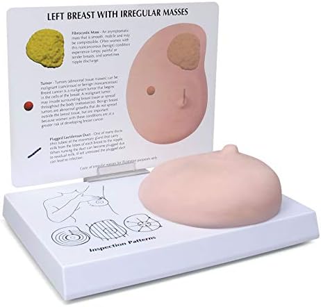 Breast Model | Human Body Anatomy Replica of Breast w/Irregular Masses for Doctors Office Educational Tool | GPI Anatomicals