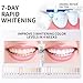 GMaxit 7.5% Hydroxyapatite Toothpaste for Advanced Enamel Protection,Appropriate for Sensitive Teeth,Gentle and Effective Formula,Fresh Mint,4.23 oz