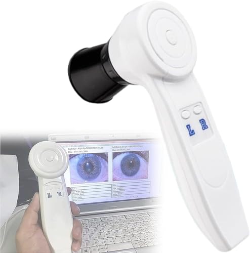 Amazon.co.jp: 自動虹彩検出器虹彩分析カメラ、HD 130万ピクセル