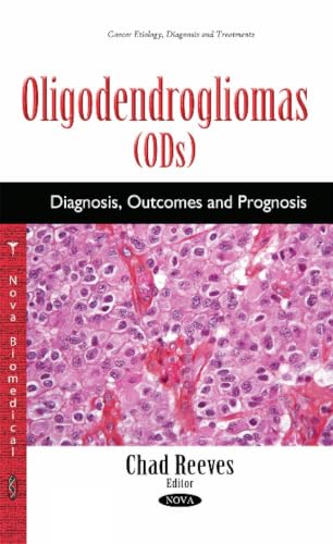 Oligodendrogliomas: Diagnosis, Outcomes and Prognosis