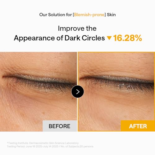 Image of MEDIHEAL Vitamin C Collagen Capsule Eye Patches (60 Count) Radiance & Glow | with Encapsulated Vitamin C | Puffy Eyes & Dark Circles | 70mm Wide Patch | 0.00 Irritating | Korean Hydrogel Under Eye Patch