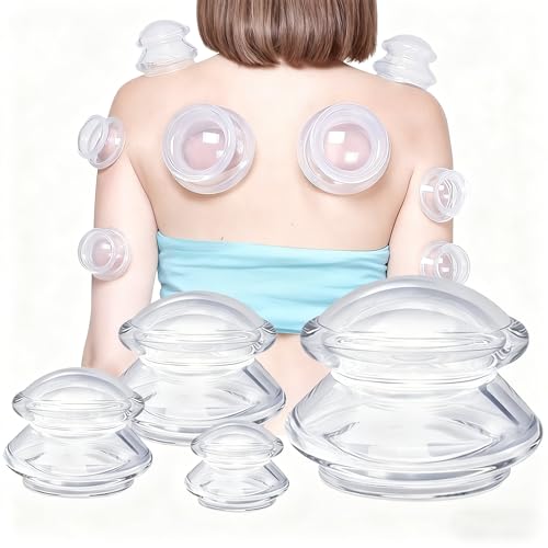 Esshogo 4 Stück Silikon Schröpfgläser Vakuum Schröpfköpfe Cupping set Vakuum massagegerät Saugglocke für massage Vakuum saugnapf set für Ganzkörpermassage und Stressabbau Ganzen