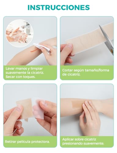 Miniatura 6 de Parches Cicatrizantes 150 Cm Reutilizables - Tiritas Cicatrizantes Médicas Para Cesáreas Queloides, Hipoalergénico, Transpirable, Impermeable